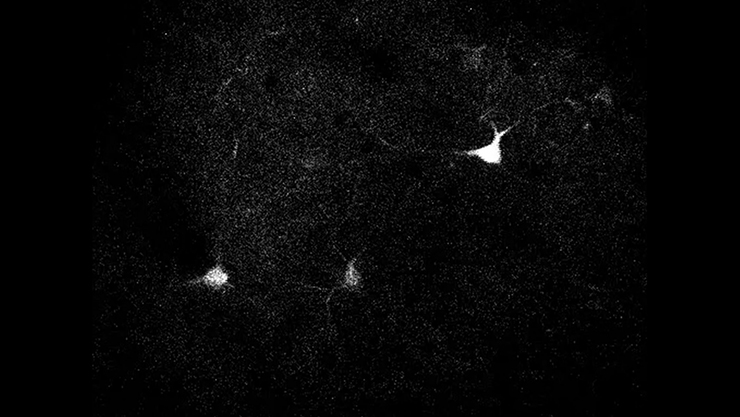 Two-photon imaging shows neurons firing in a mouse's brain. 